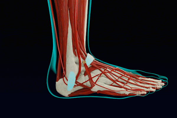 Kompressionsstrümpfe Performance