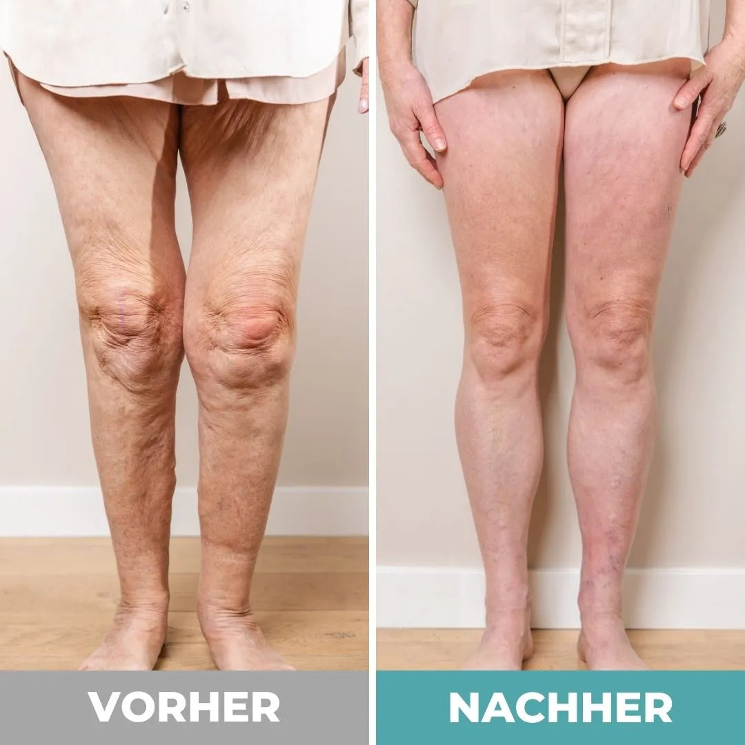Orthofabrik® Fußmassagegerät
